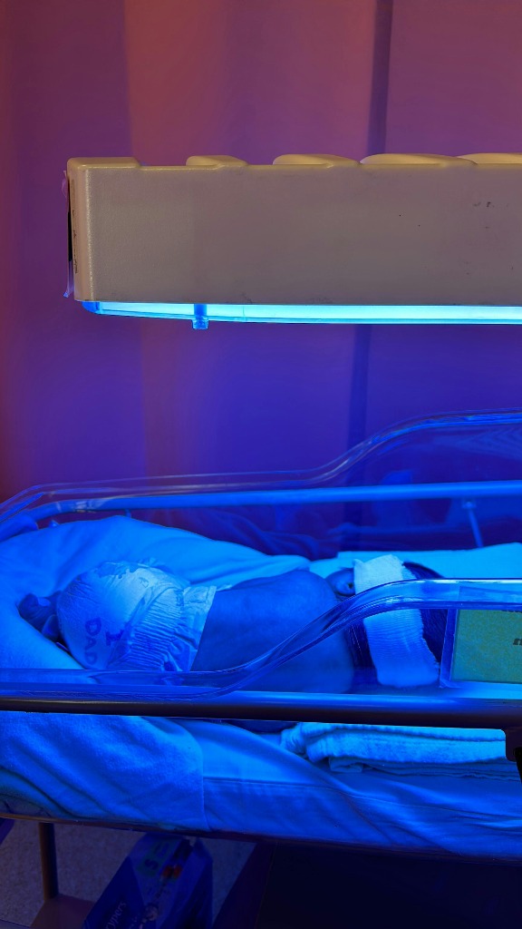 Neonatal Jaundice